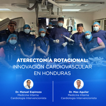 Aterectomía Rotacional: Innovación Cardiovascular en Honduras
