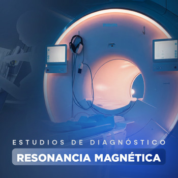 Estudios de  Resonancia Magnética en HDV